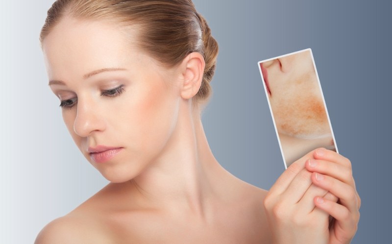 7 Side Effects of Laser Hair Removal Method 