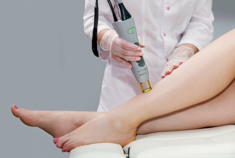 Hair removal cosmetology procedure from a therapist at cosmetic beauty spa clinic. Laser epilation. Cosmetology and SPA concept.