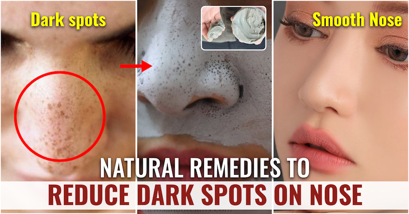 Reduce Dark Spots on Nose