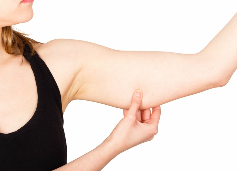 Woman showing loose upper arm thanks to unhealthy lifestyle.
