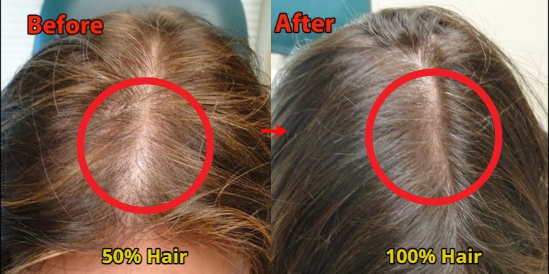 8 Ways to Regrow Thinning Hair 