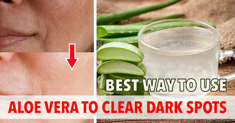 Best way to use aloe vera for dark spots