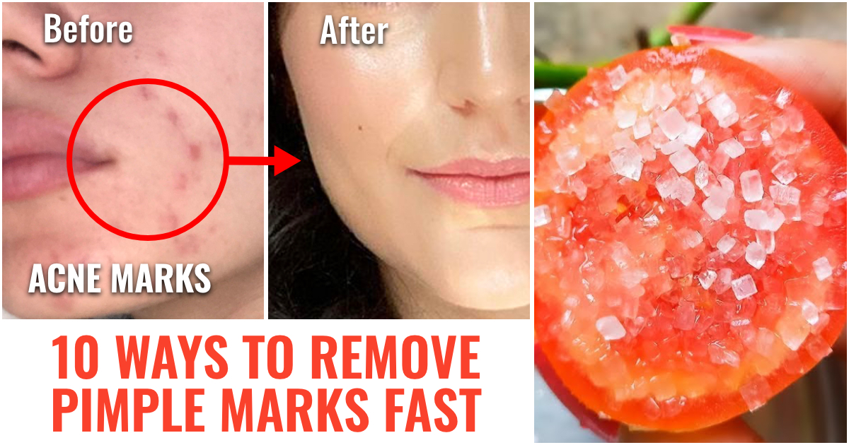 8 Ways to Naturally Oily Skin | Makeupandbeauty.com