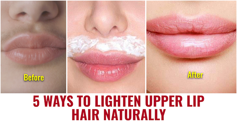 7 Ways to Lighten Upper Lip Hair Naturally 