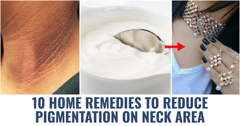 Reduce Pigmentation on neck area