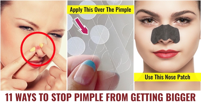 Stop pimples