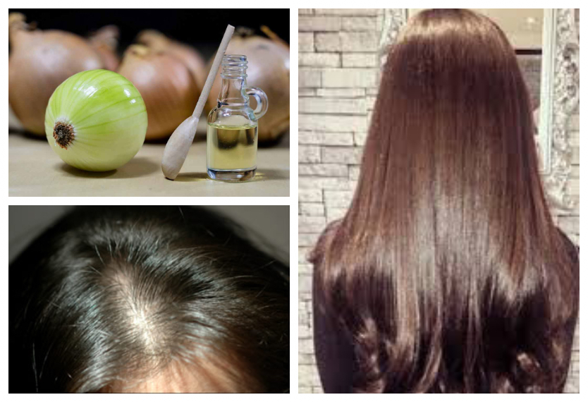 10 Effective Home Remedies to Reduce Hair Fall and Cure Baldness |  
