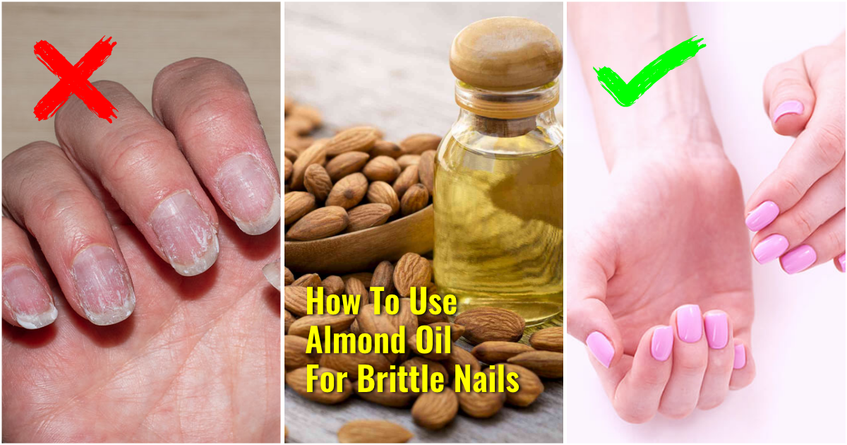 7 Home Remedies for Brittle Nails That Work Like a Charm!