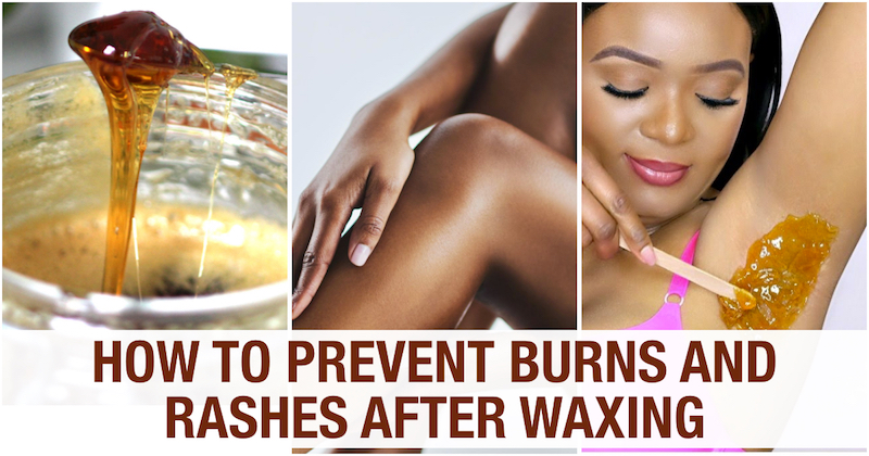 how to prevent post wax burns and rashes