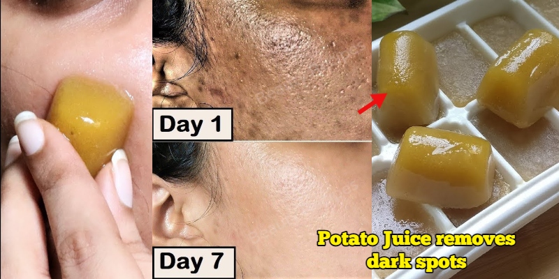 potato-juice-dark-spots