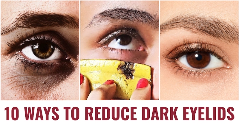 Dark eyelids remedies