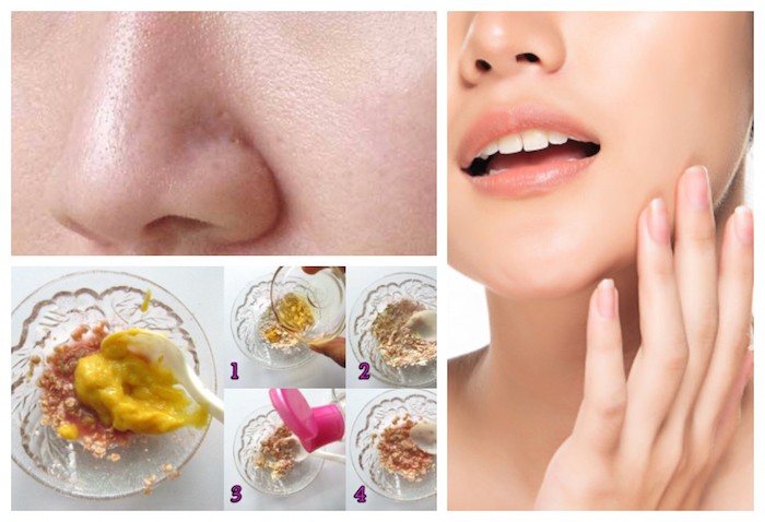 Ways To Reduce Large Facial Pores in Summers