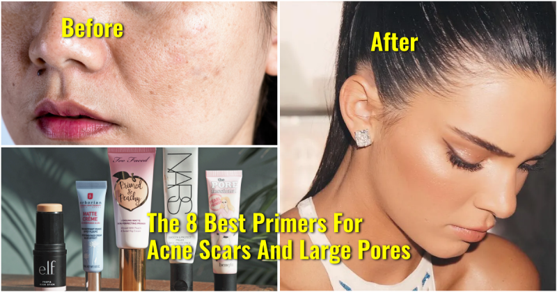 8 Best Primers for Large Pores and Acne Makeupandbeauty.com