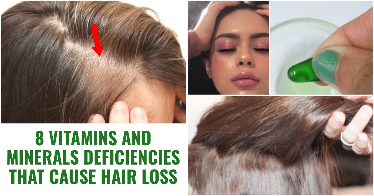 8 Vitamins and Minerals Deficiencies that Cause Hair Loss |  