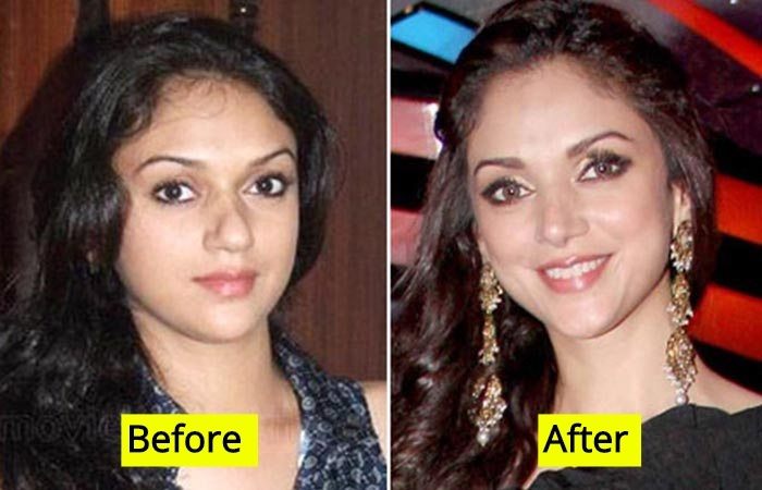 Then and Now Looks of 10 Bollywood Actresses Who Have Undergone Plastic  Surgery 