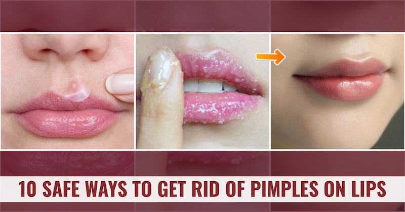 Lip pimples