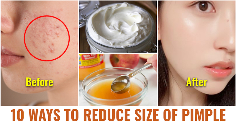 Reduce pimple size