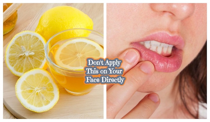 can we apply lemon on the face