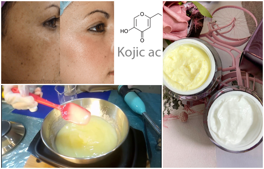 Can Kojic Acid Permanently Lighten Skin
