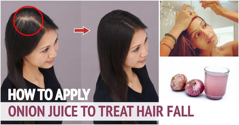 2 Weeks Challenge - Hairfall Control Onion Oil + Organic Bamboo Vinegar Hair  Mask | Stop Hair Fall - YouTube
