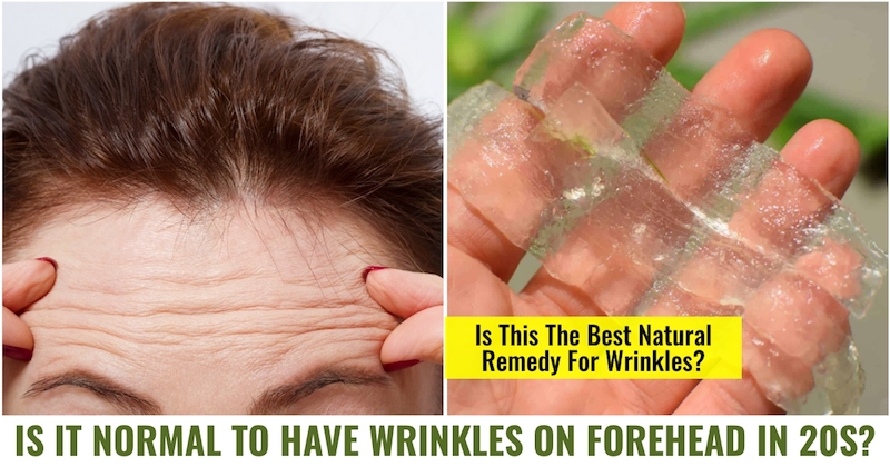 Wrinkles forehead