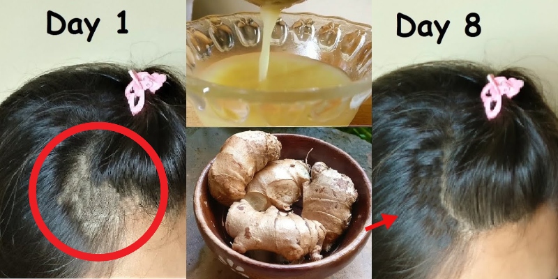 GINGER JUICE FOR HAIR