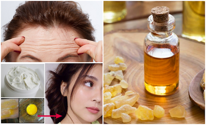 Effective Ways to Reduce Appearance of Forehead Wrinkles