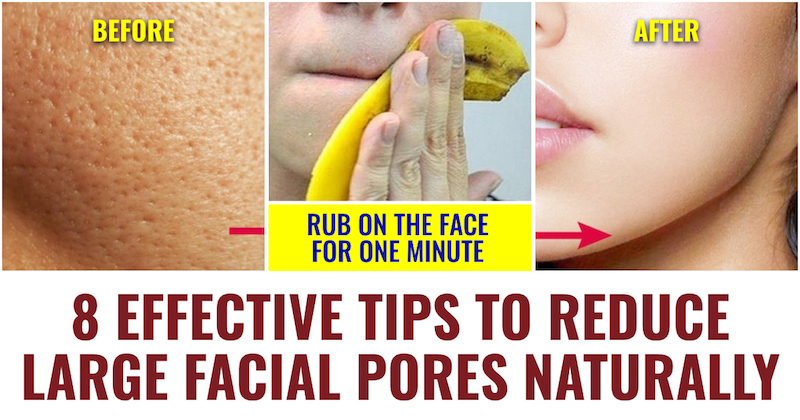 Reduce Large Facial Pores Naturally