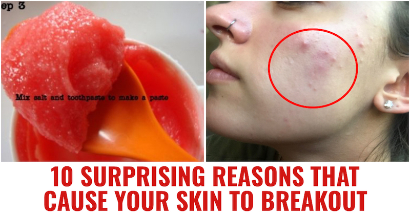 Surprising Reasons That Cause Skin to Breakout