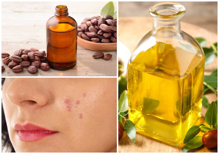 Why Jojoba Oil is Great for Acne prone and Oily Skin