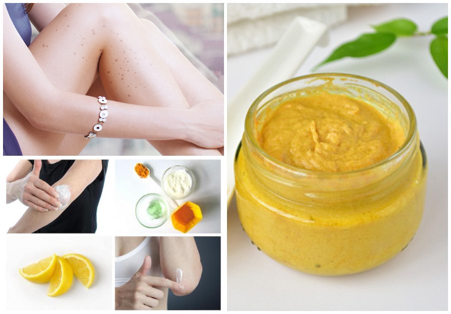 Packs to Remove Dark Spots from Arms and Legs