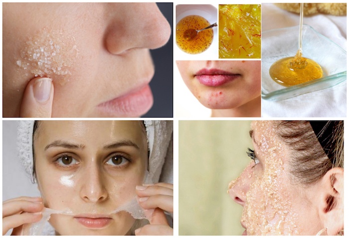 How To Fix Dry Patches On The Face