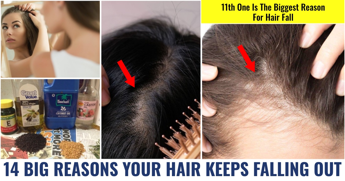 14 Big Reasons your Hair Keeps Falling Out 
