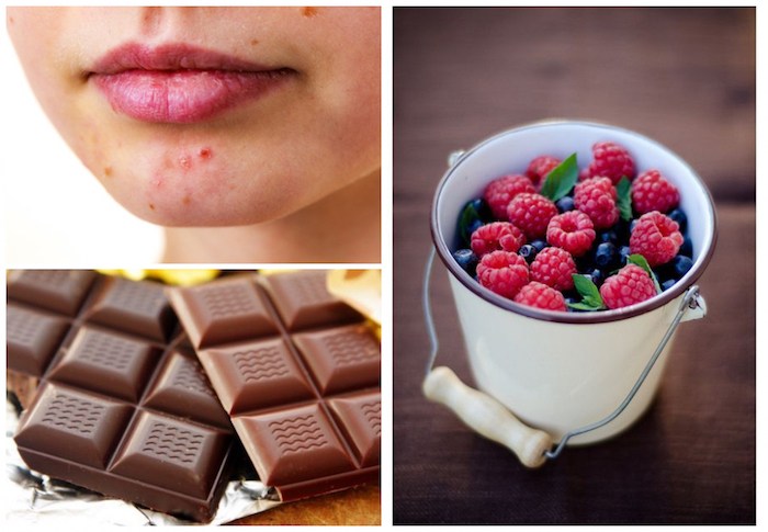 Foods That Help Reduce Acne Flare Ups