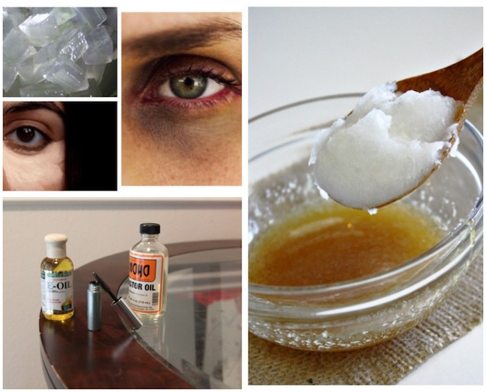 How To Use Castor Oil to Clear Dark Circles