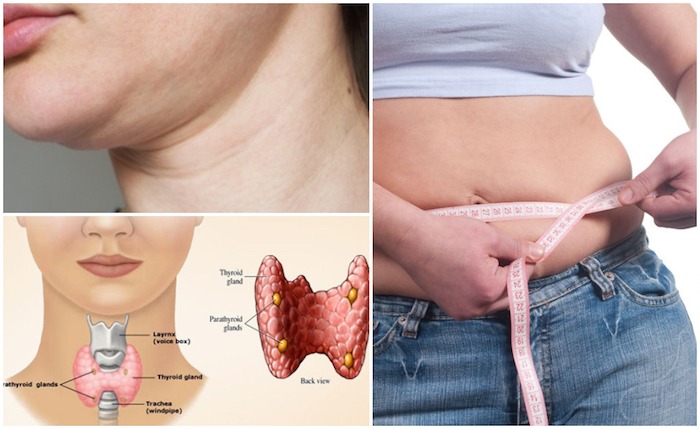 How to Lose Weight with Hypothyroidism