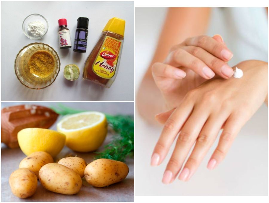 homemade remedies for hands 1