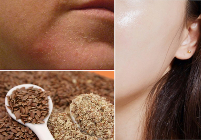 Foods to Eat For Nourishing Dry Skin