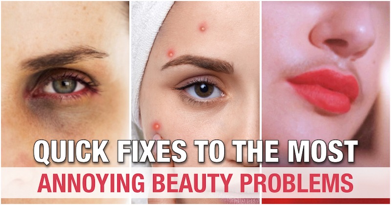 Most Annoying Beauty Problems All Women Face