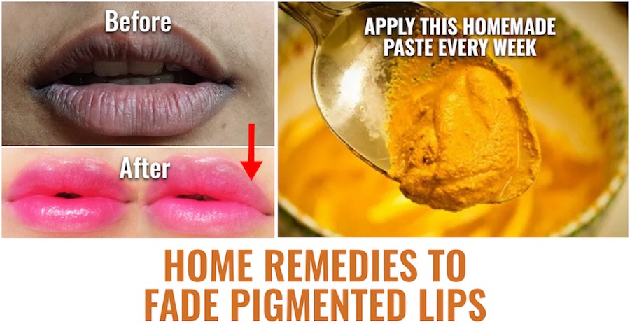 Lip pigmentation
