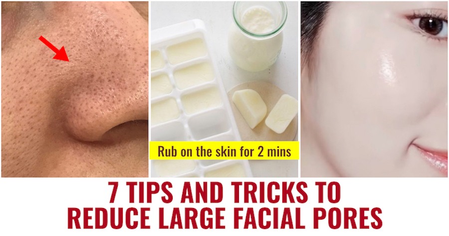 Tips and Tricks To Reduce Large Facial Pores
