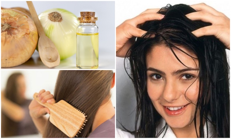 6 Onion Hair Packs to Control Hair Loss 