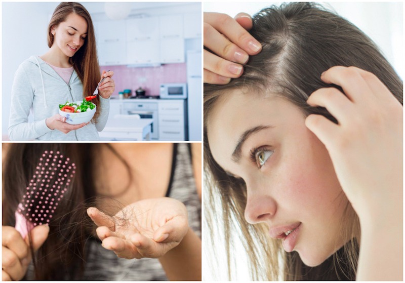 Foods That Could Cause Hair Loss