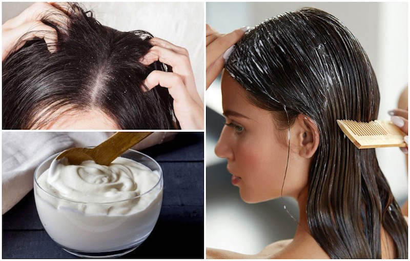 Natural Ingredients To Get Rid of Dandruff