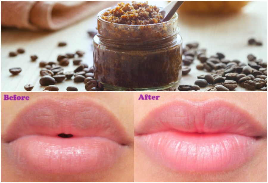 Tips For Softer Lips